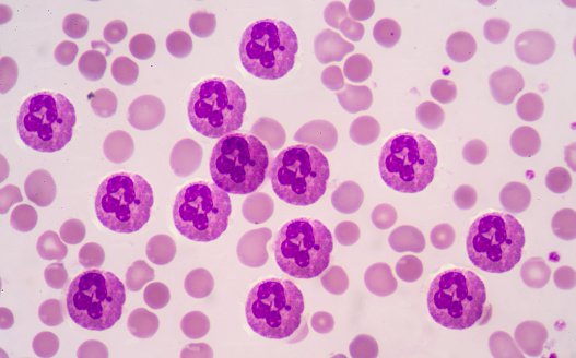 Immature and mature blood cells MILF